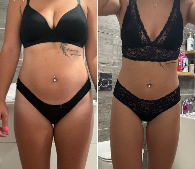 Premena – Daniela pred a po, mínus 10 kg
