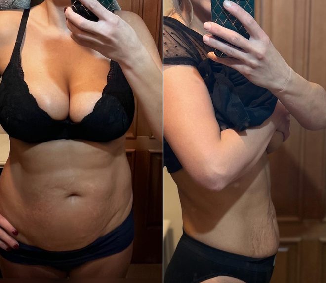 Premena – Lenka pred a po, mínus 11,8 kg